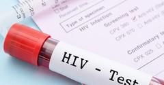 Что нужно знать о ВИЧ и СПИД