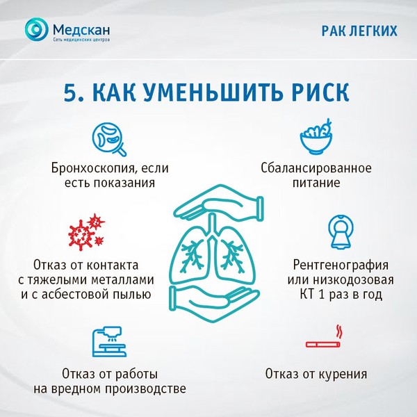 rak-legkih5.jpg