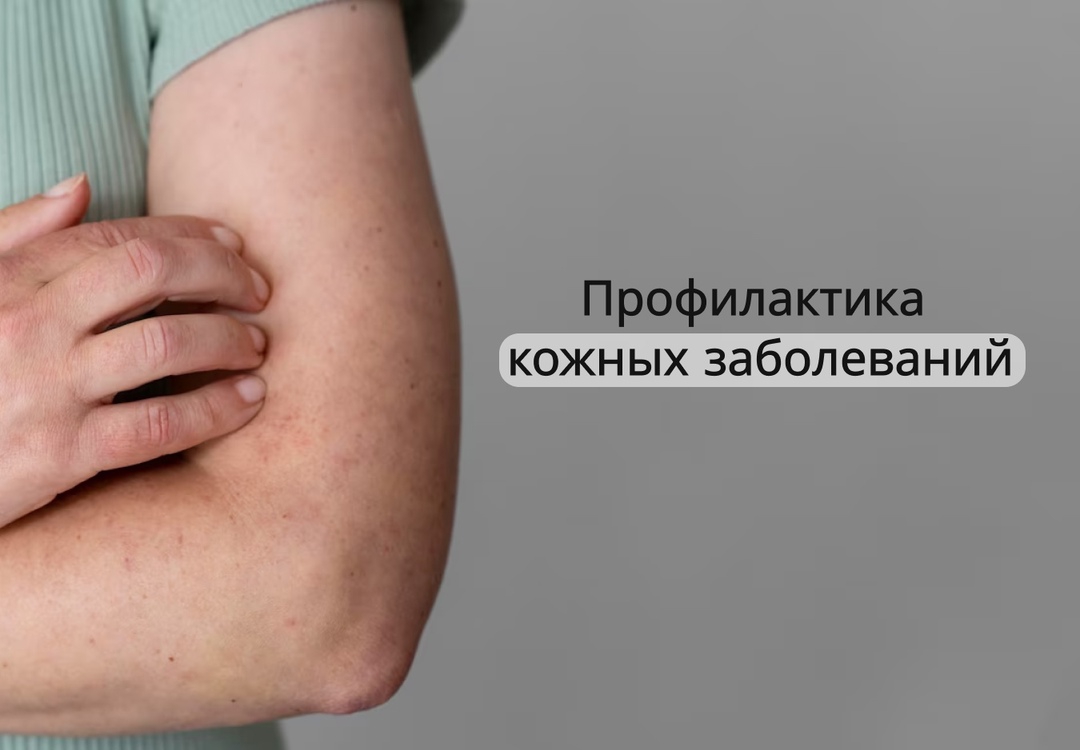 svcdz1m4hx5ttswvkscytm8dqctvs4huv2i9qhn75yl4pnu-loccobsp3zzzjos_PWSCT8u.jpg